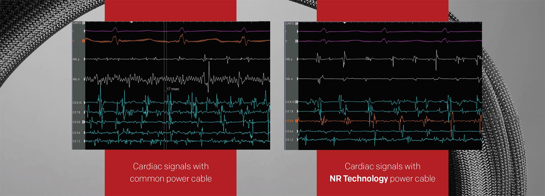 NR Cardiac Signals Comparison