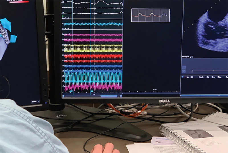 cci-noise-reduction